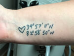 Tattoo Removal