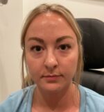 Injectable Fillers/Botox