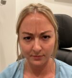 Injectable Fillers/Botox