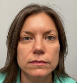 Injectable Fillers/Botox