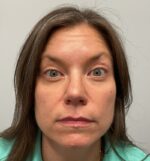 Injectable Fillers/Botox