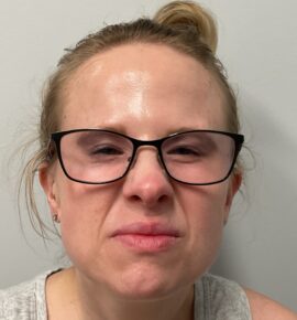 Injectable Fillers/Botox