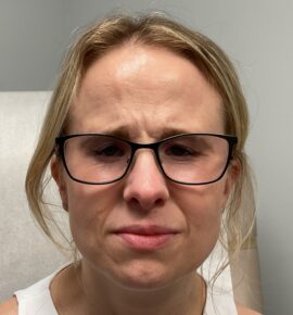 Injectable Fillers/Botox