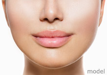 Juvederm Restylane Los Angeles