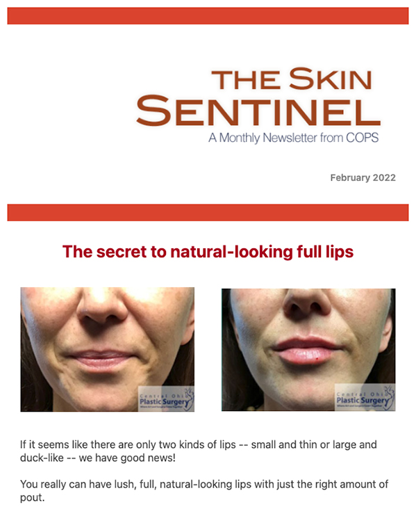 The Skin Sentinel Monthly Newsletter - February 2022