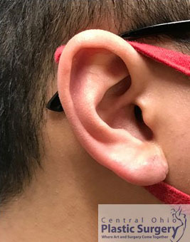 After