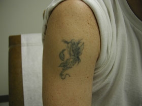 Before