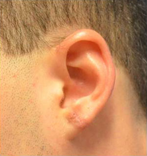After